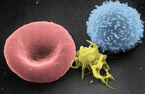 The red blood cell is the largest and the white blood cell is similar in size to the red blood cell. The platelet is the smallest and is seen between the red blood cell and the white blood cell.