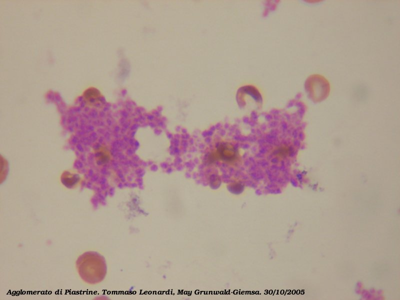 The platelets appear like a mass of small red chunks of cells. They are dyed pink.
