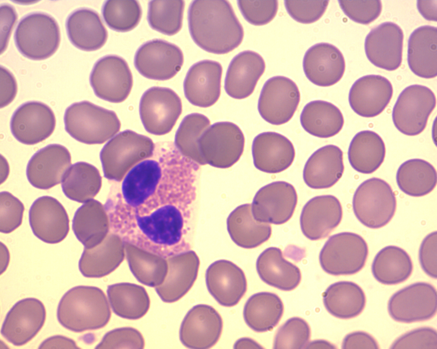 eosinophils