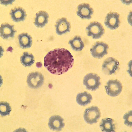A basophil in the middle of several red blood cells.