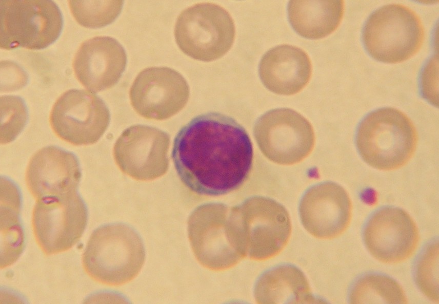 lymphocytes