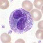 Eosinophil photo