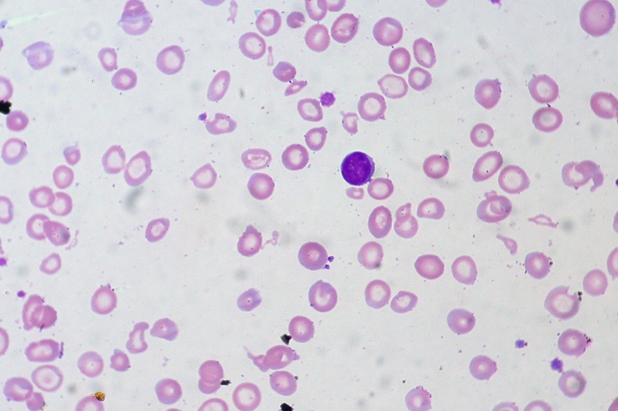 blood smear containing neutrophils